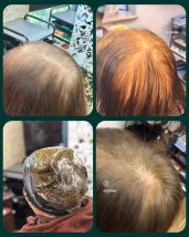 ヘナには大きく分けて2種類あります.「ヘナって全部同じでしょ？」実は…ここを知らないと失敗します