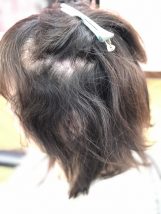 ✔ 表面はそこまででも ✔ 内側のクセが強い ✔ 湿気で広がる ✔ 朝まとまらない ストレス解消